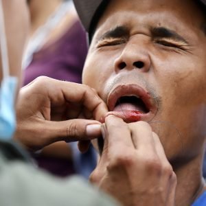 Protesta de labios cosidos